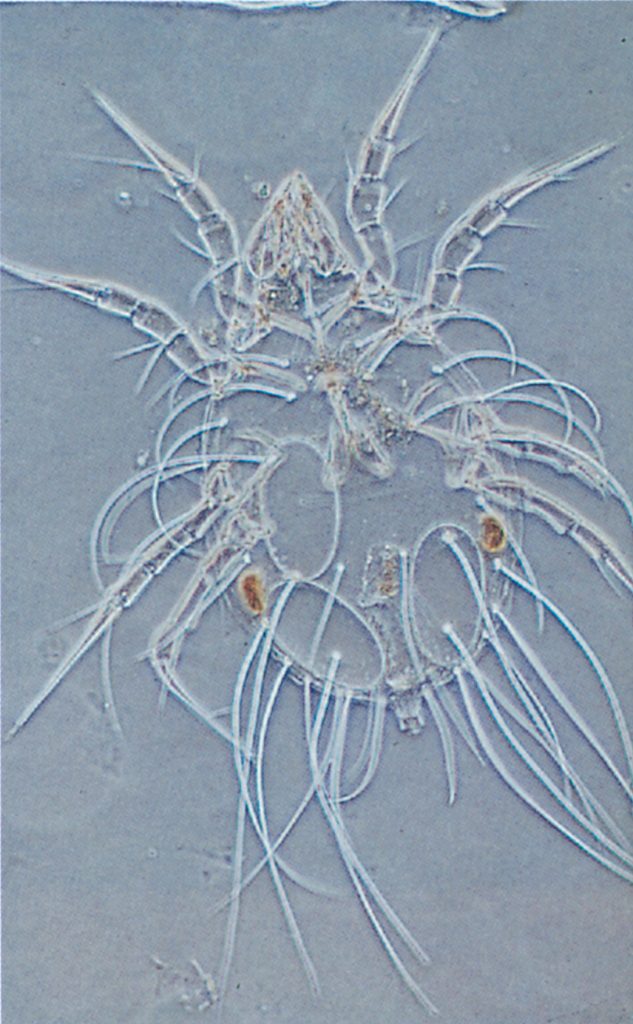 House mite under microscope